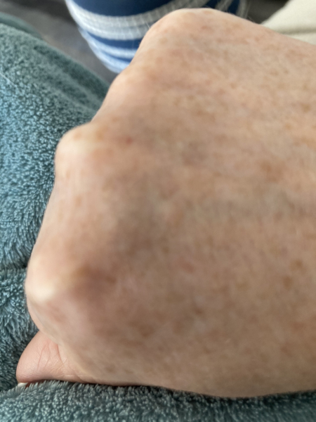 What is this on my hand? 