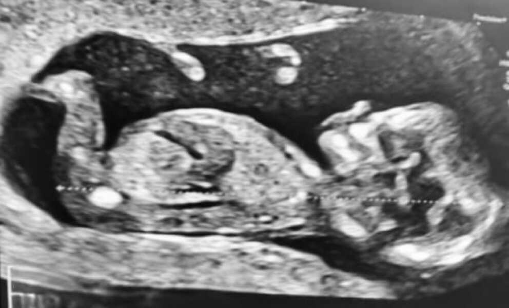 TWW - Testing Around 1st March 