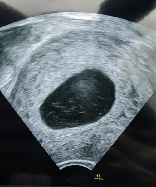 Empty sac floating white debris?