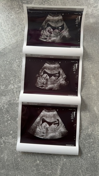 Nub Theory! Any gender guesses please? x