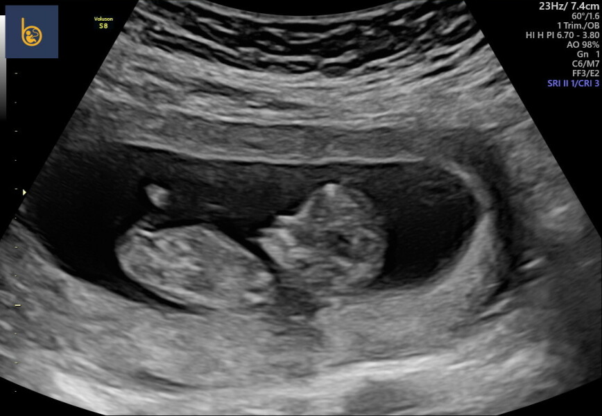 Gender guesses 