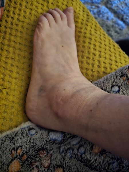 Minor injuries unit for this?