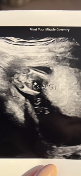 Anyone worried their private gender scan is wrong?