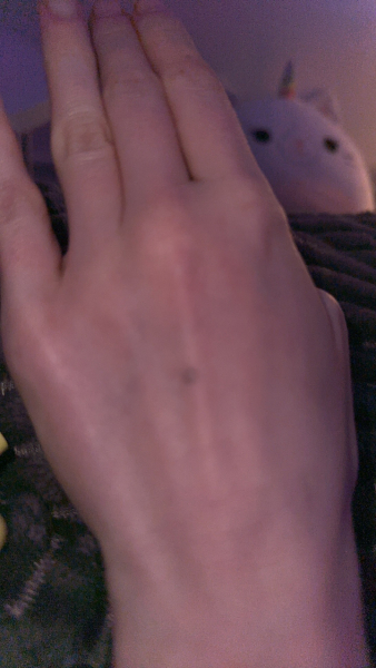 What is this on my hand? 
