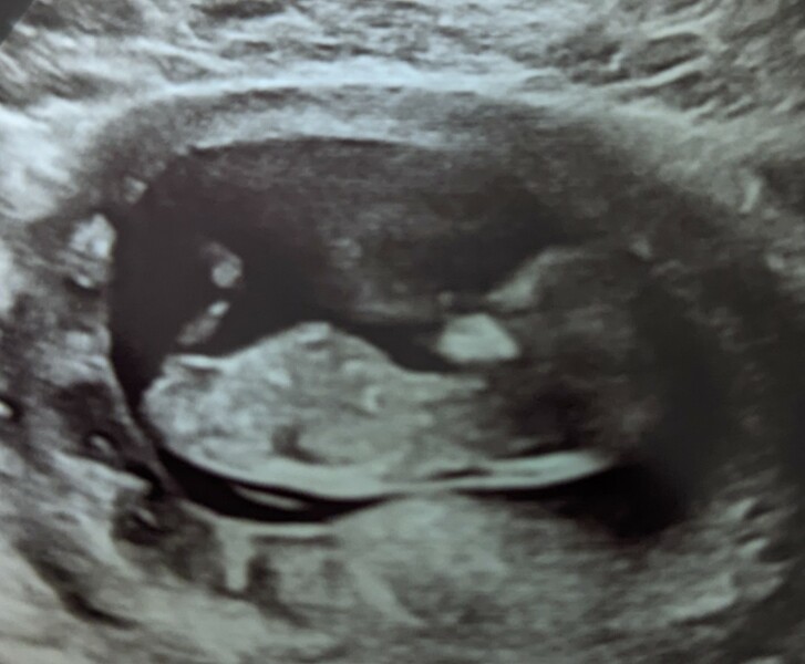 Boy or girl?