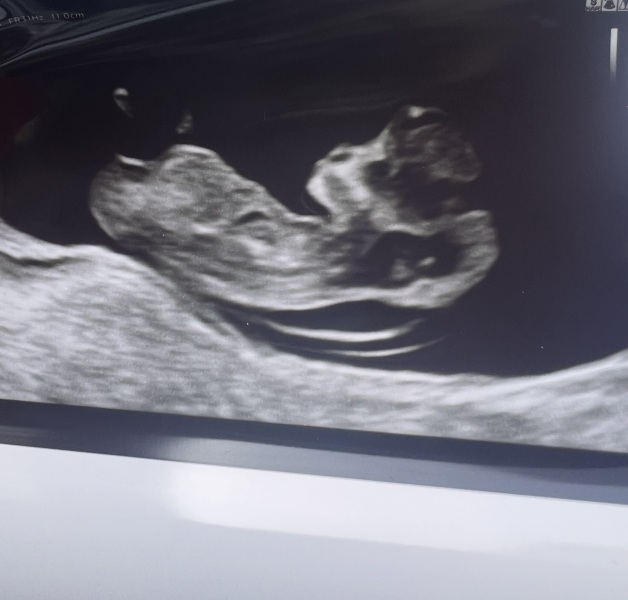 Gender guesses based on scan ? 