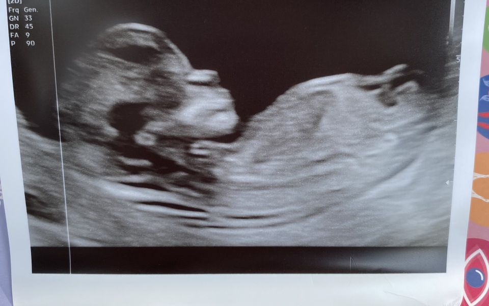 Boy or girl?