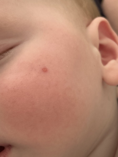 7 months old, spot?! 