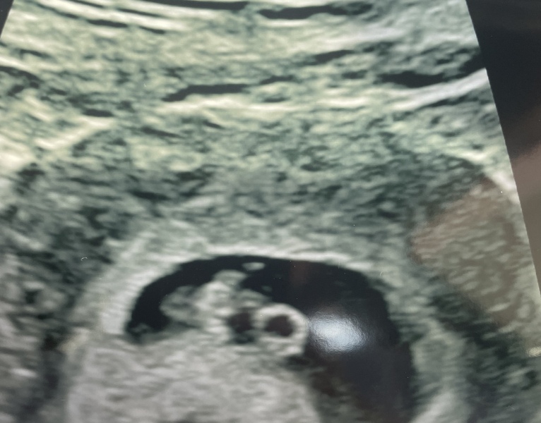 6dpo positive pregnancy test 