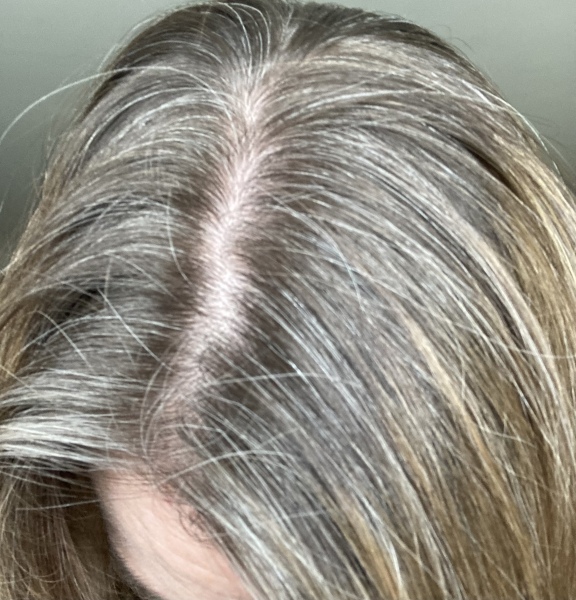 Grey hair really getting me down 