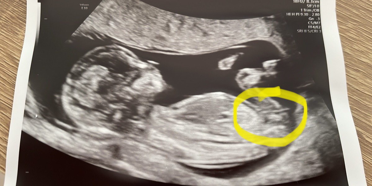 Curious to know sex of baby 
