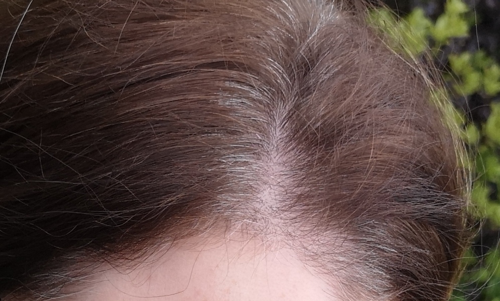 Is it that unusual to be grey in 30s?