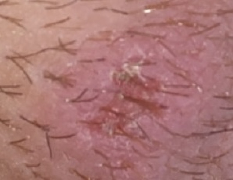 Weird bumps and lumps during pregnancy