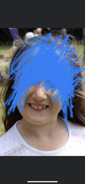 Orthodontic treatment 