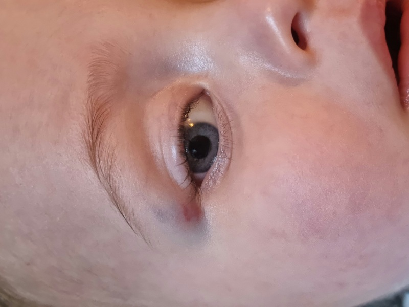 Would you get this checked out?