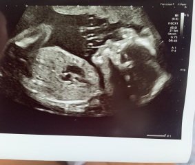 22 weeks boy or girl?