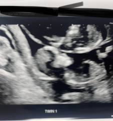 Gender (skull theory?) 