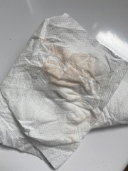 Implantation bleeding-help? TW photos 