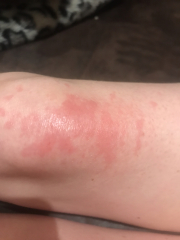 Does anyone know what this is?