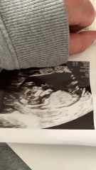 12wk + 6days. Girl or boy?