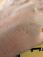 Just ageing hands or something to worry about?