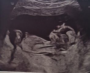 Girl or boy 