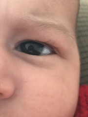 Eye colour