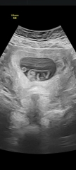 Can the yolk sac move?