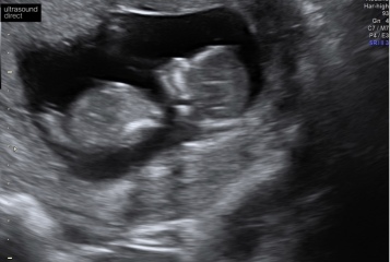 Due November 2023 Part 3