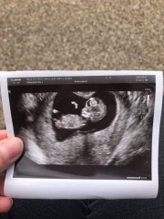 Scans - skull theory/genders
