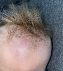 Toddler hit head, I’m panicking! 