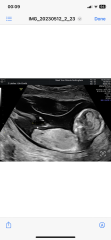 What do people think baby is 