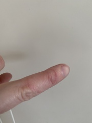 What is this on my finger? 