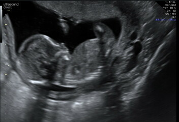 Due October 2023 - thread 6