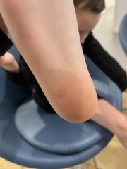 Any idea what these spots are? 