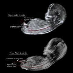Nub theory 