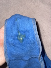 Green and Yellow discharge after postpartum sex HELP!