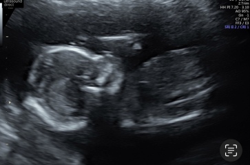 TWW - Testing Around 1st March 