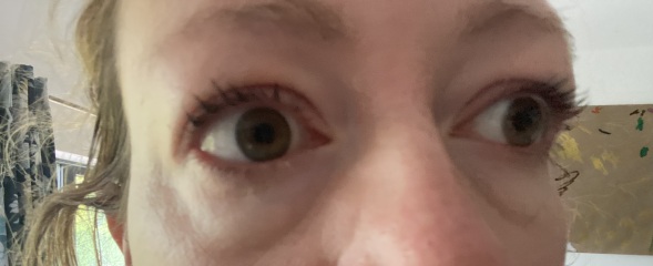 Is there a magic cream to tighten eye bags?!