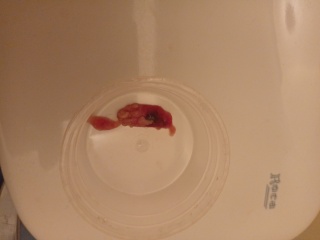 TW - pictures included! Why am I bleeding? Any medical professionals about please?