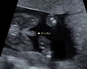 TWW - Testing Around 1st March 