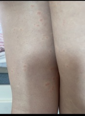 What could this rash be..? (Pics included)