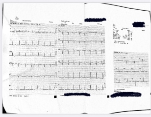 ECG results. Please help. 