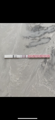 Is my line getting weaker? Just had light pink spotting after bowel movement - cervical ectropion 
