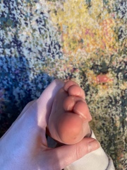 Overlapping toes 