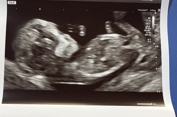 Boy or Girl?
