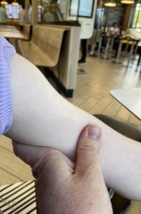 Help - lump appeared on arm