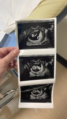 Scans - skull theory/genders