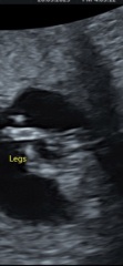 12 weeks! Potty shot and nub guesses?