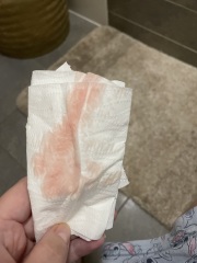 Light bleeding photos attached 